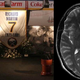 Illustration for article titled Why Sports Dont Need Concussions To Destroy Players Brains